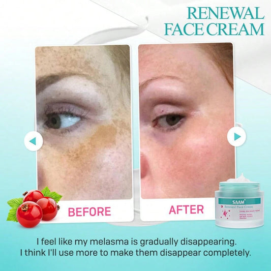 Brightening Facial Cream, Suitable For Melasma Skin, Moisturizing And Nourishing
