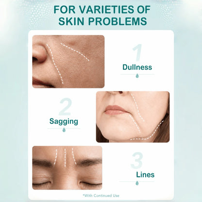 Brightening Facial Cream, Suitable For Melasma Skin, Moisturizing And Nourishing