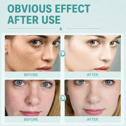 Brightening Facial Cream, Suitable For Melasma Skin, Moisturizing And Nourishing